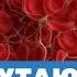 Что путают с тромбом Гипертония и внезапная смерть