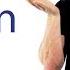Elbow Flexion Test Cubital Tunnel Syndrome