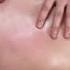 Массаж спины и шеи техника Сутулость массаж Back Massage