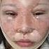제니st 성형 가능한거였음 Jennie