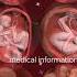 Baby Moment In Womb Sangal Twins Triplets Baby Moment Shortvideo Shorts