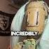 Soldier Built Himself A Bionic Arm