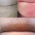 Duet Aesthetic Ekmotahathighumechala Skincare Lips Edit