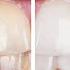 Healthy Teeth And Gums Subliminal