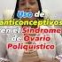 Un Dato De Una Ginecóloga Actualizada Sobre El Tratamiento Del SOP Ginecologia Draolvera SOP