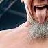 Black Tooth Metal Battle Turkey Live At Wacken Open Air 2024
