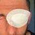 I LOST MY EYEBALL