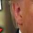 Amukan Trump Makin Parah Staf Khawatir Dia Mengidap Demensia