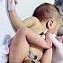 Management Of Abdominal Destinations Niculife Premature Neonatalicu Neonatologist Cute Cute