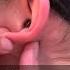 3 Ways To Stop A Laryngospasm Attack Shorts Fauquierent