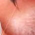 Why Mosquitoes Buzz In Your Ear Deep Look