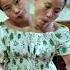 Tasbih Song Conjoined Twins Sister Omg New Tiktok Video Godblessyou Shorts Viralshorts Newtiktok