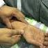 Icushort 252 How To Properly Position Hand For Taking ABG Sample Esbicm Shorts