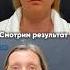 Спейслифтинг 1 неделя после операции лифтинг подтяжкалица омоложение