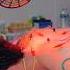 ASMR Incredible Chinese Electric Acupuncture Chiropractic And Cupping Massage Shorts