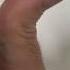 Can Your Thumb Do This