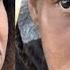Has Elaine Worsened Or Improved In 2 Years