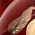 Gallbladder Removal Surgery Open Cholecystectomy Shorts Gallbladder Creativelearning3d