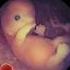 9 Weeks Baby Real Video From Womb Incredible Pregnancy Fetus