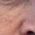 Elon Musk Appears At White House With Black Eye Announces Departure
