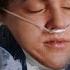Young Patient Dies Due To Undiagnosed Metabolic Disease Chicago Med MD TV