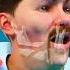 How Brass Knuckles Work