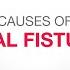 Causes An Anal Fistula