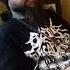 EPICARDIECTOMY COMPLETE DISCOGRAPHY REVIEW