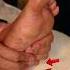 Here How To Relax Your Foot By Yourself Couple Foottherapy Footmassage Footpain Massage