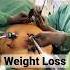 How We Do WEIGHT LOSS TREATMENT Bariatric Surgery Fat Removal