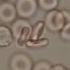 Red Blood Cells Under The Microscope Hypo And Hypertonic Solutions