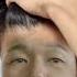 50만 머리숱 상위 20 만 알고 있는 탈모 진단법 끝까지 보면 여친 생김