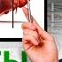 Печень кричит о ПОМОЩИ Как РАСПОЗНАТЬ серьезные заболевания ПЕЧЕНИ