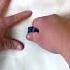 How To Remove Old Blood Stains