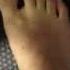 Intrinsic Foot Strengthening By Dr Spina