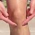 Got Patellar Tendon Pain Try This Out