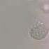 Curious What Snot Or Phlegm Looks Like Under The Microscope Shorts Snot Phlegm Wbcs Fyp