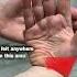 3 Tests For Carpal Tunnel Syndrome