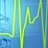 New Data Signals A Slowing Down In New NHS Activity Under Labour