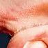 Why Super Glue Is Perfect For Gluing Skin