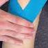 How To Tape For Knee Pain Discomfort