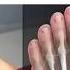 Gout Kenthomeopathyclinic Drkukrejakalani 8291492566 Homeopathydoctor