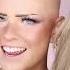 Bald To Blonde The RESULTS Video