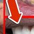 You Will NOT Believe How EASY You Can WHITEN Your Teeth Amazing