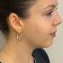 Rhinoplasty Turkey Dr Ahmet Dilber Rhinoplastyturkey Rhinoplasty Plasticsurgery