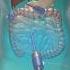 Gallbladder Removal Surgery 3D Medical Animation Shorts Gallbladder