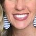 HOW TO WHITEN TEETH NATURALLY Top 4 Tricks In Minutes
