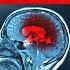 Laura Delano The Dark Truth About Antidepressants SSRIs And The Psychiatrists Lying For Profit