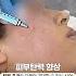 주기적으로 꼭 추천해드리는 스킨보톡스 특징들 스킨보톡스 피부관리