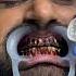 Teeth Whitening Powder Dentistteeth Teethwhiteningproducts Doctor Toothdental Teethwhitening